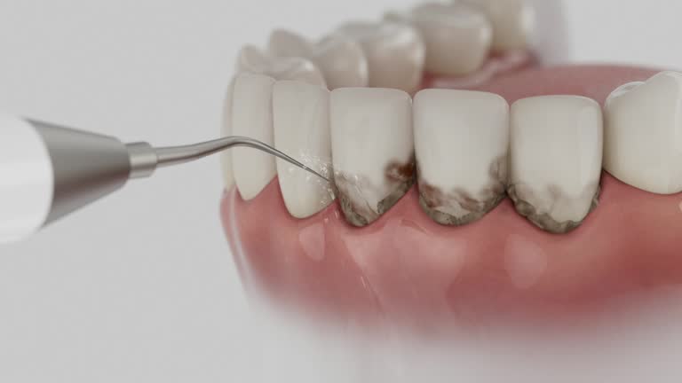 Reliable Teeth Cleaning And Checkup contractor in Gray County County, KS by Dentist Open Now